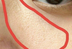 麻豆儿毛周角化修复霜,焕肤新选择，告别粗糙肌肤